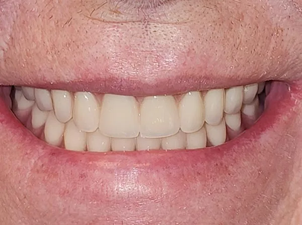 After image