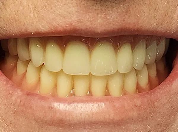 After image