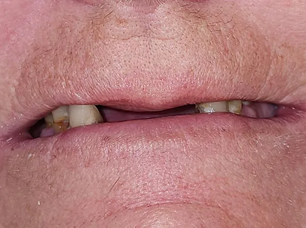 Before image
